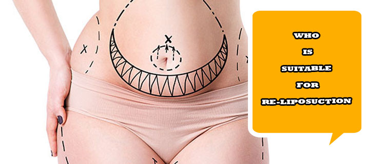 Who is suitable for re-liposuction