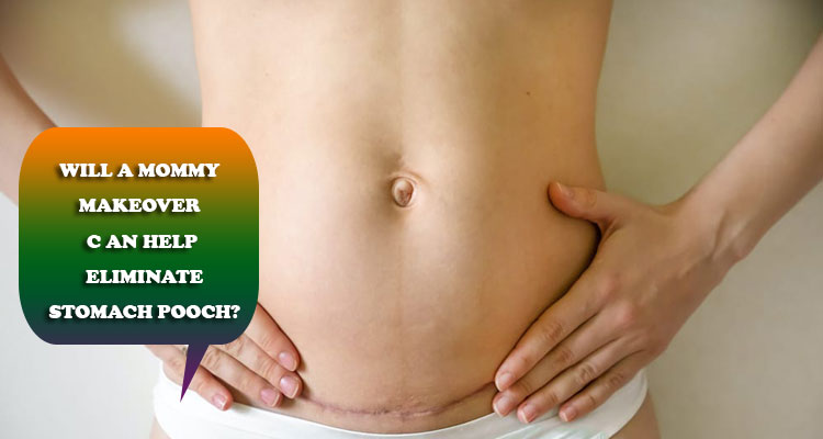 Will a mommy makeover can help eliminate stomach pooch?