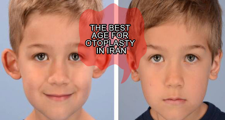 The best age for otoplasty in Iran