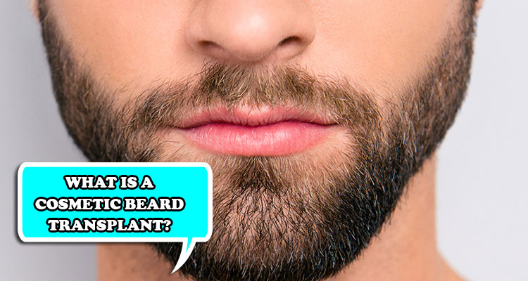 What is a cosmetic beard transplant?