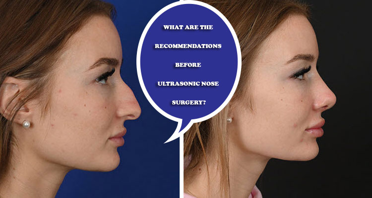What are the recommendations before ultrasonic nose surgery?
