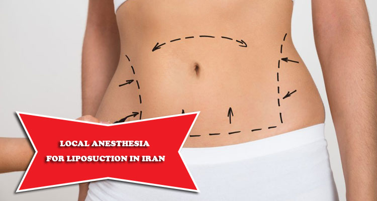 Local anesthesia for liposuction in Iran