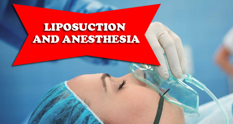  anesthesia