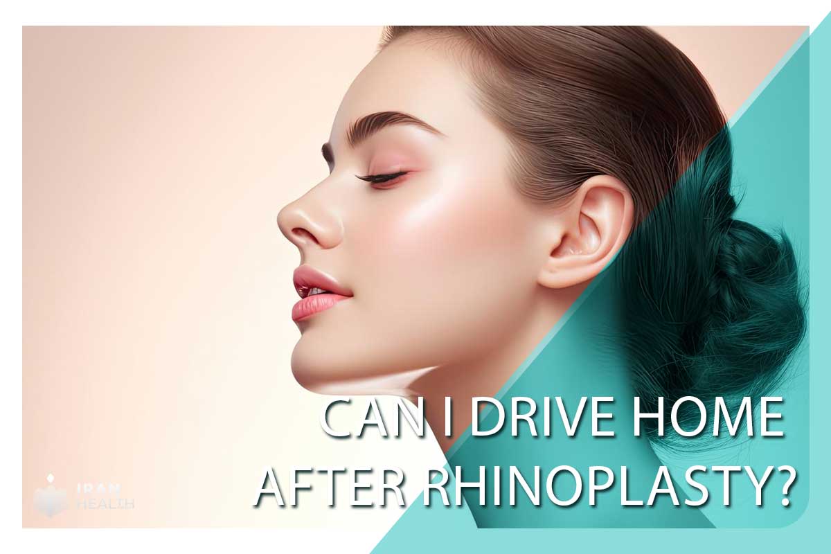 Can I drive home after rhinoplasty?