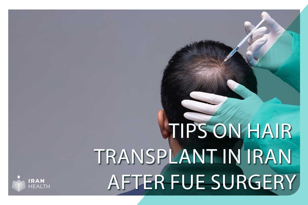 Tips on hair transplant in Iran after FUE surgery