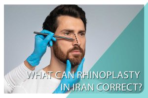 What can rhinoplasty in Iran correct