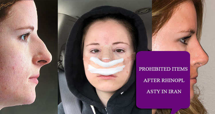 prohibited items after rhinoplasty in Iran