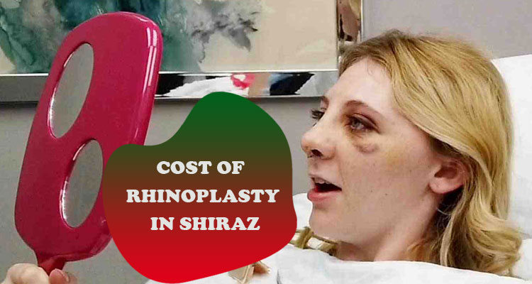 Cost of rhinoplasty in shiraz