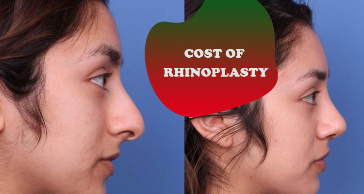 cost of rhinoplasty