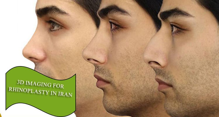 3D imaging for rhinoplasty in Iran