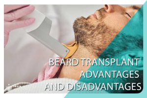 Beard transplant advantages and disadvantages