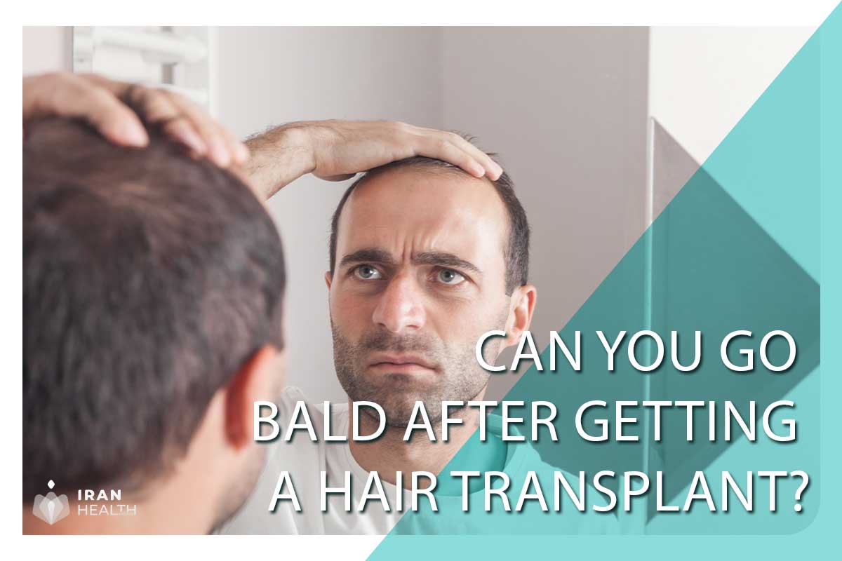 Can You Go Bald After Getting a Hair transplant?