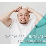 The causes and treatments for hair loss in men