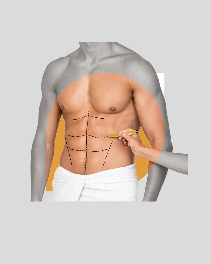 Abdominal Etching - Six Pack_