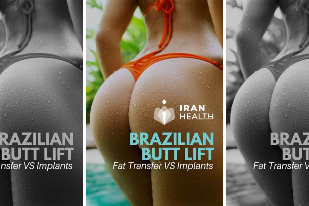 What is a Brazilian butt lift (BBL)?