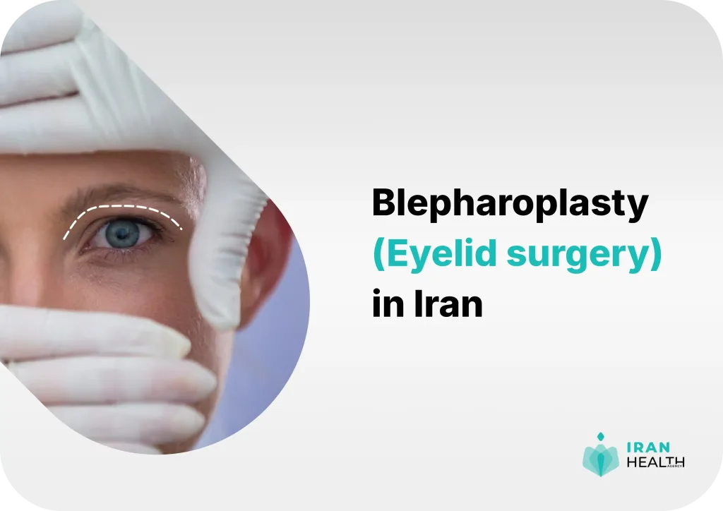 Blepharoplasty in Iran