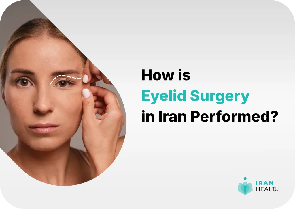 Blepharoplasty in Iran 2