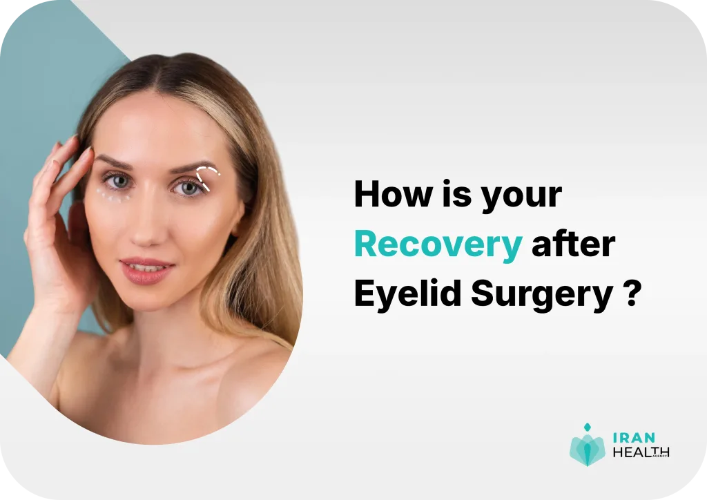 Blepharoplasty in Iran