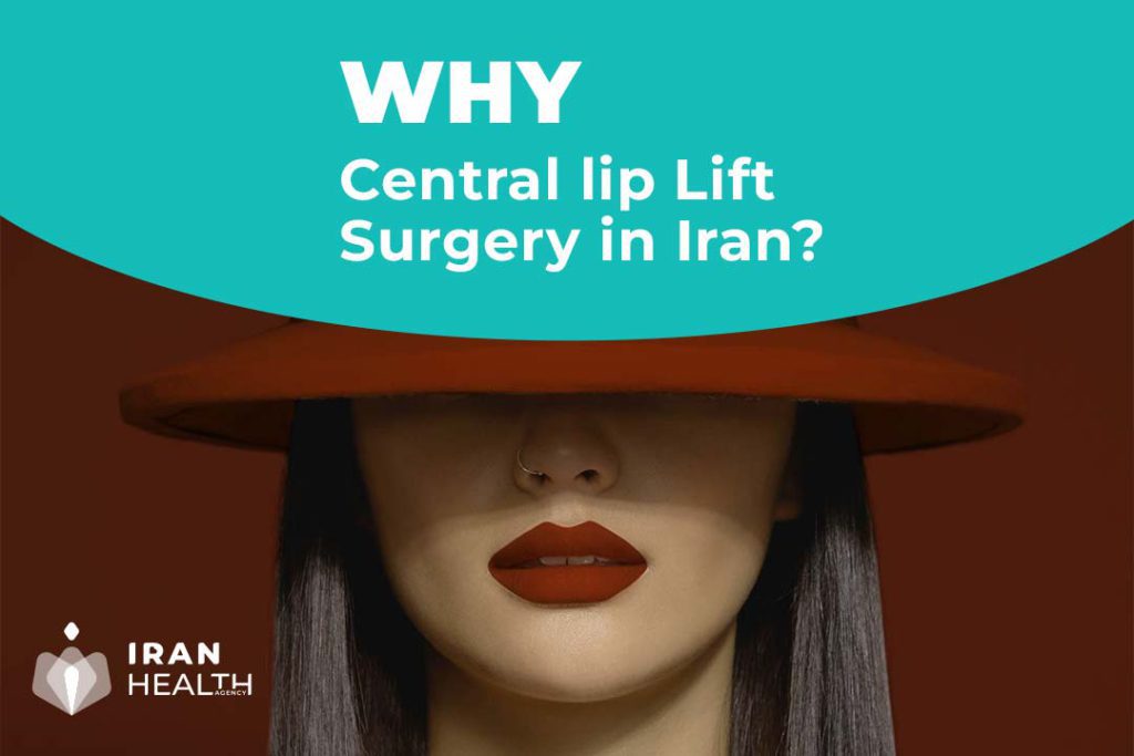 Why Central lip Lift Surgery in Iran?