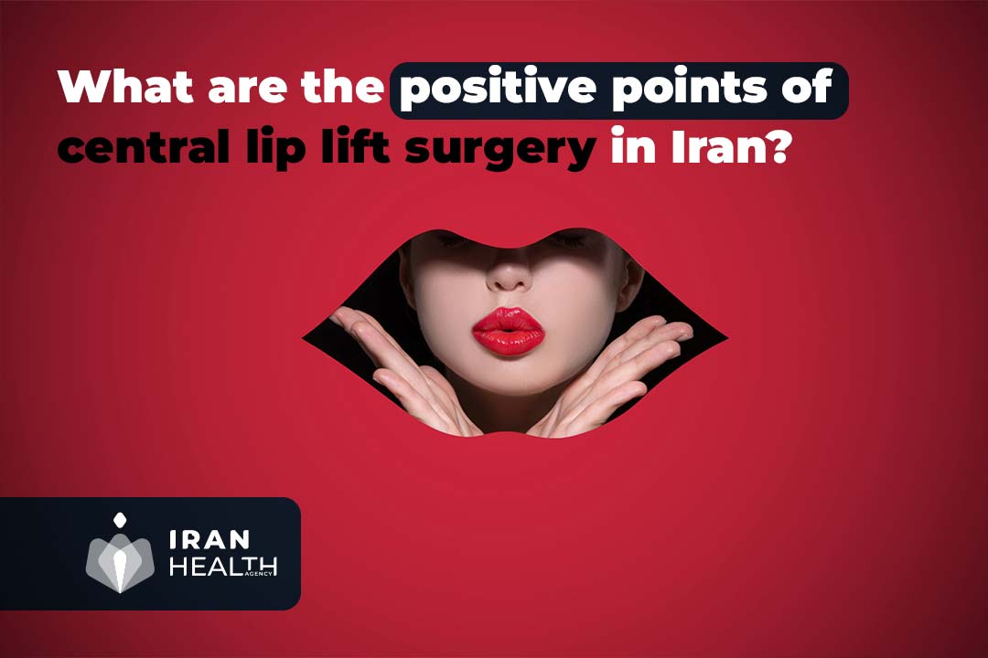 What are the positive points of central lip lift surgery in Iran?