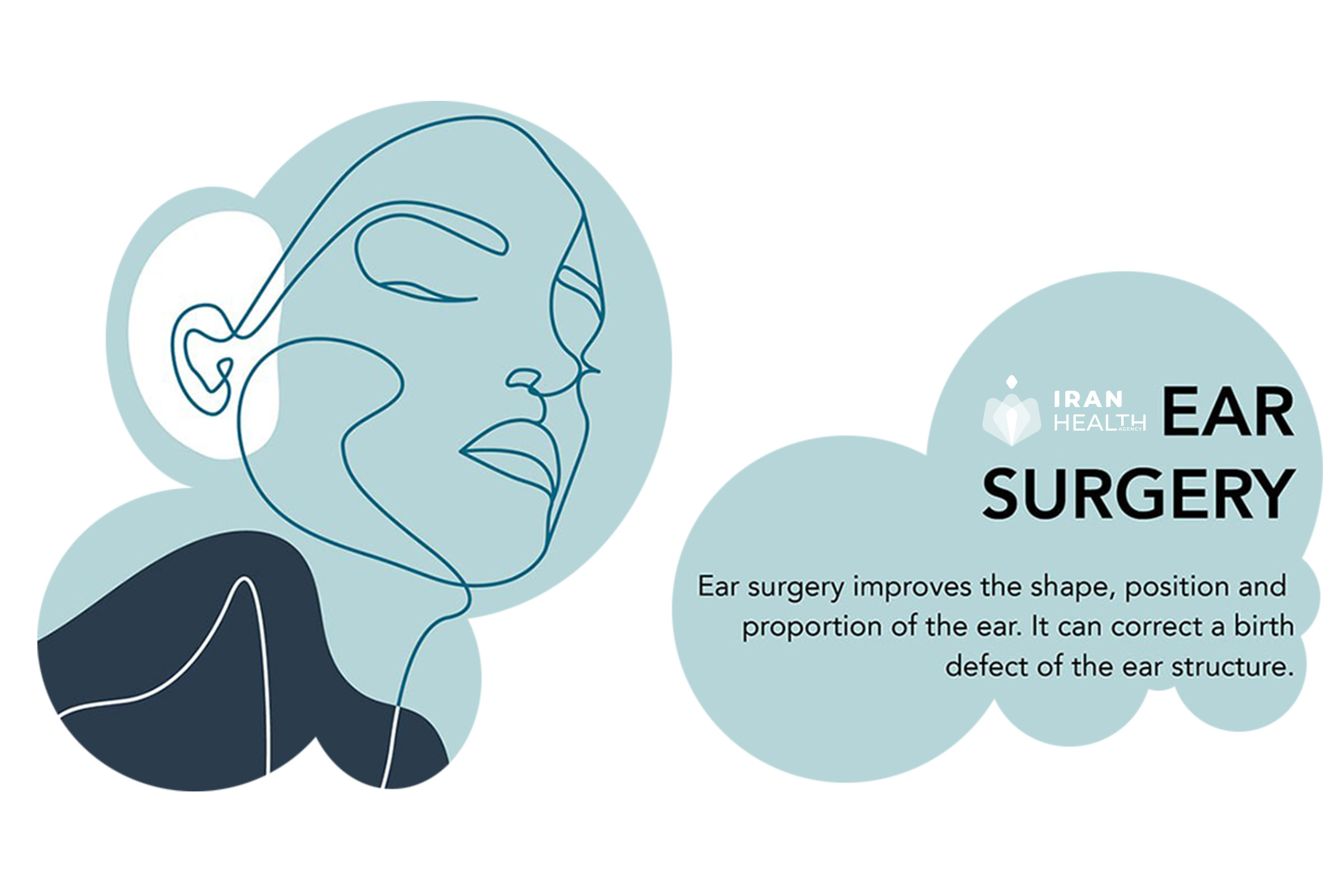 Ear Surgery in Iran or Otoplasty | iran health agency