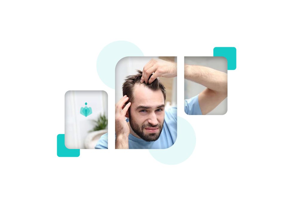 Which City Should I Choose for Hair Transplantation in Iran? | IRANHEALTHAGENCY