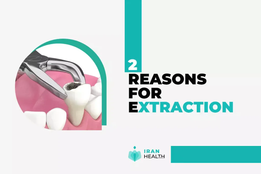 A comparison of before and after tooth extraction