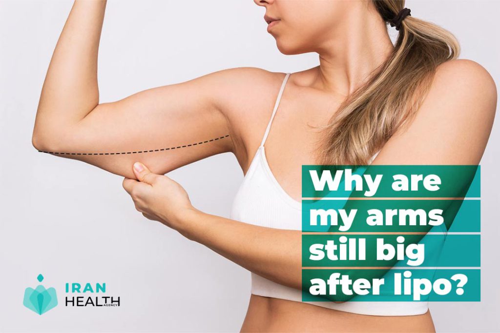 Why are my arms still big after lipo?