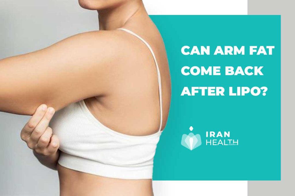 Can arm fat come back after lipo?