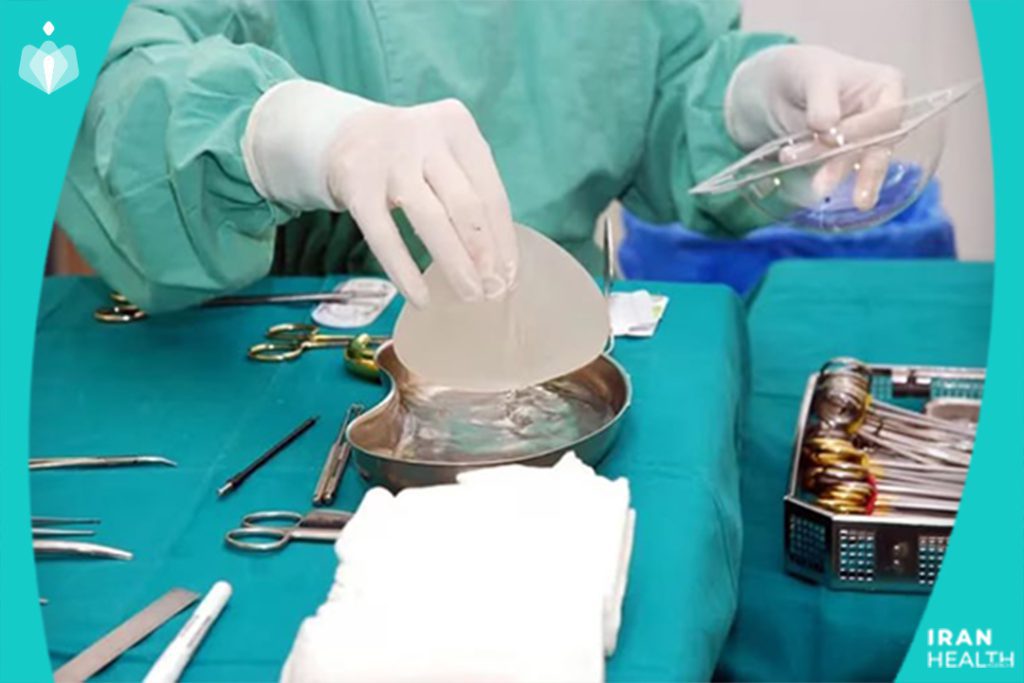 breast implant revision process
