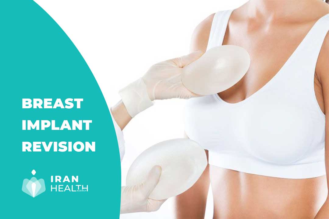 Breast Implant Revision In Iran Best Cost And Surgeon 7908