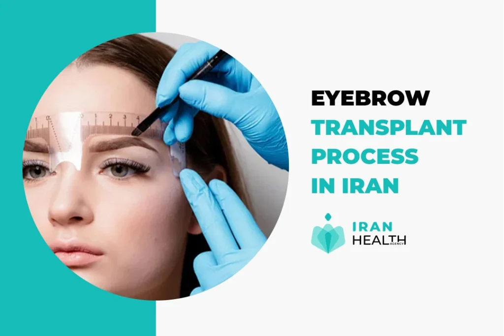 Eyebrow Transplant in Iran Expertise and value for enviable eyebrows