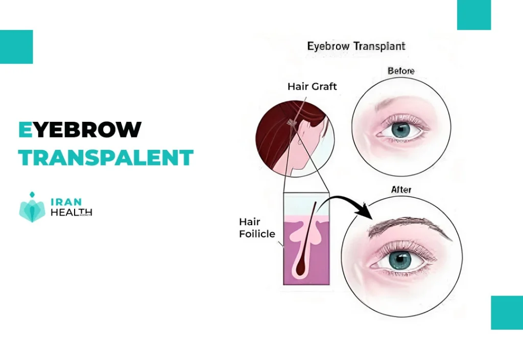 Eyebrow transpalent 2