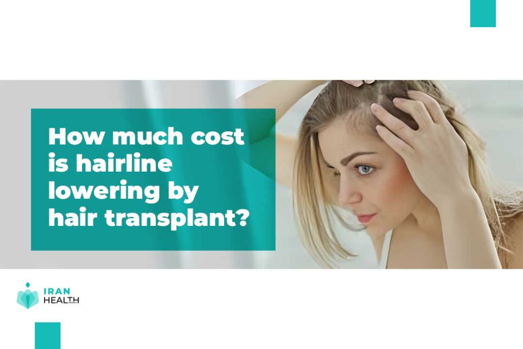 How much cost is hairline lowering by hair transplant?