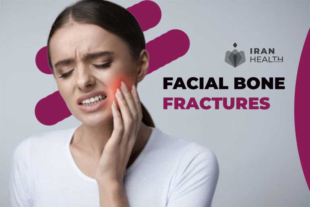Facial bone fractures