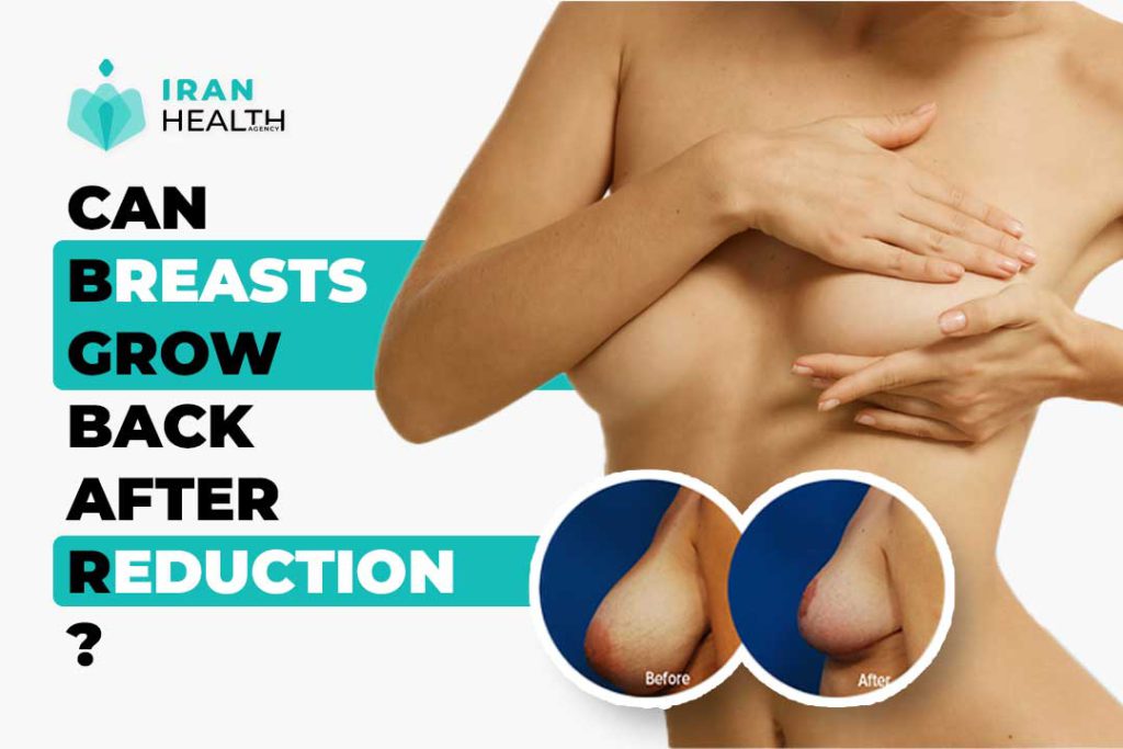 Can breasts grow back after reduction?