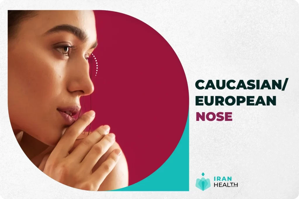 European Nose
