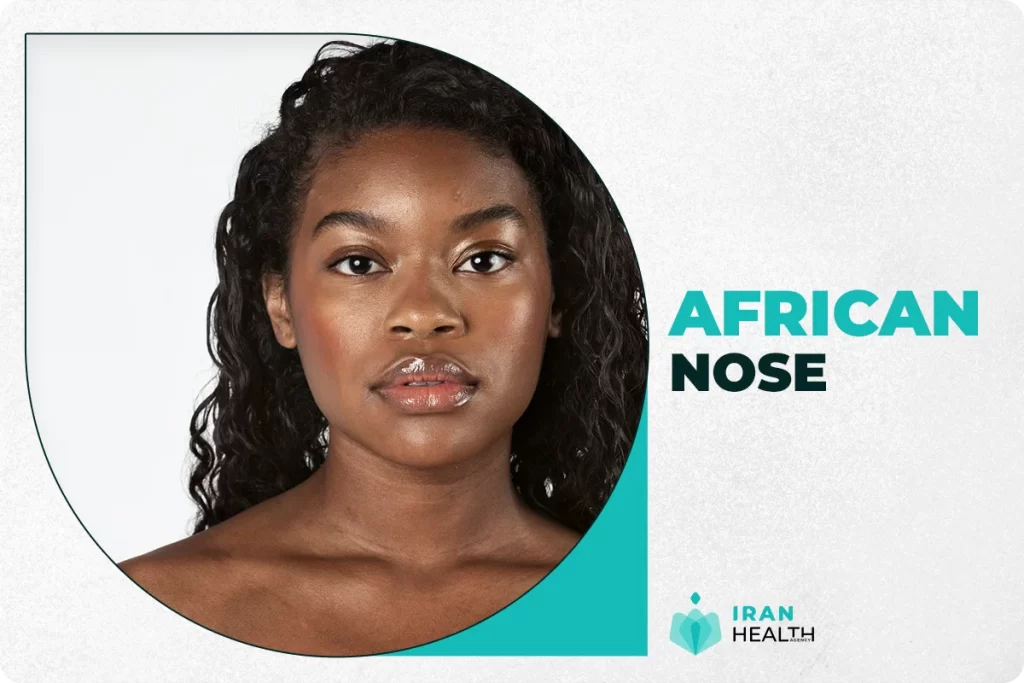 African Nose