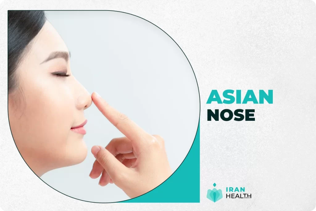 Asian Nose