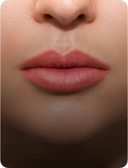 central lip lift surgery