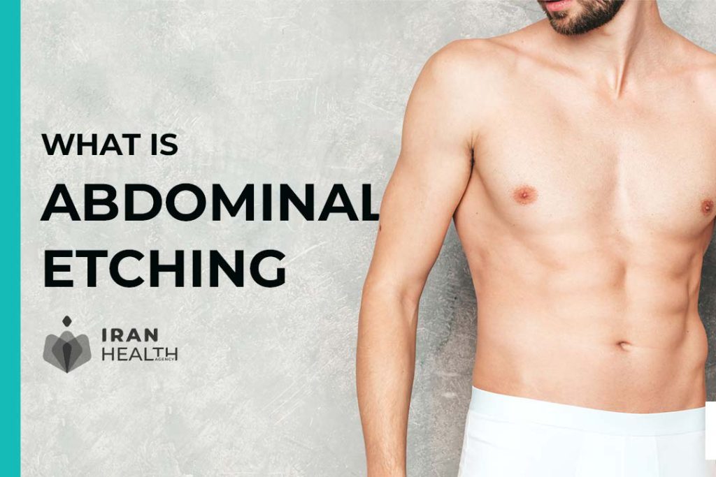 what is abdominal etching