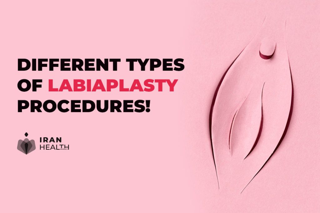 Different types of labiaplasty procedures