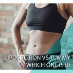 Liposuction vs Tummy tuck: which one is better? 