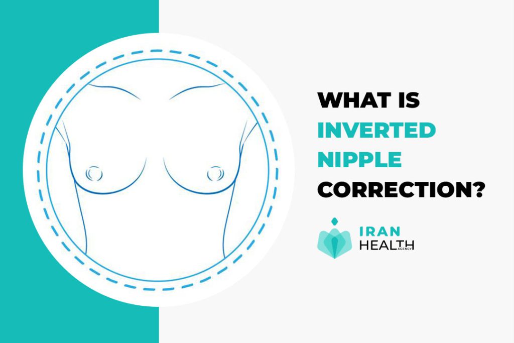 what is inverterd nipple