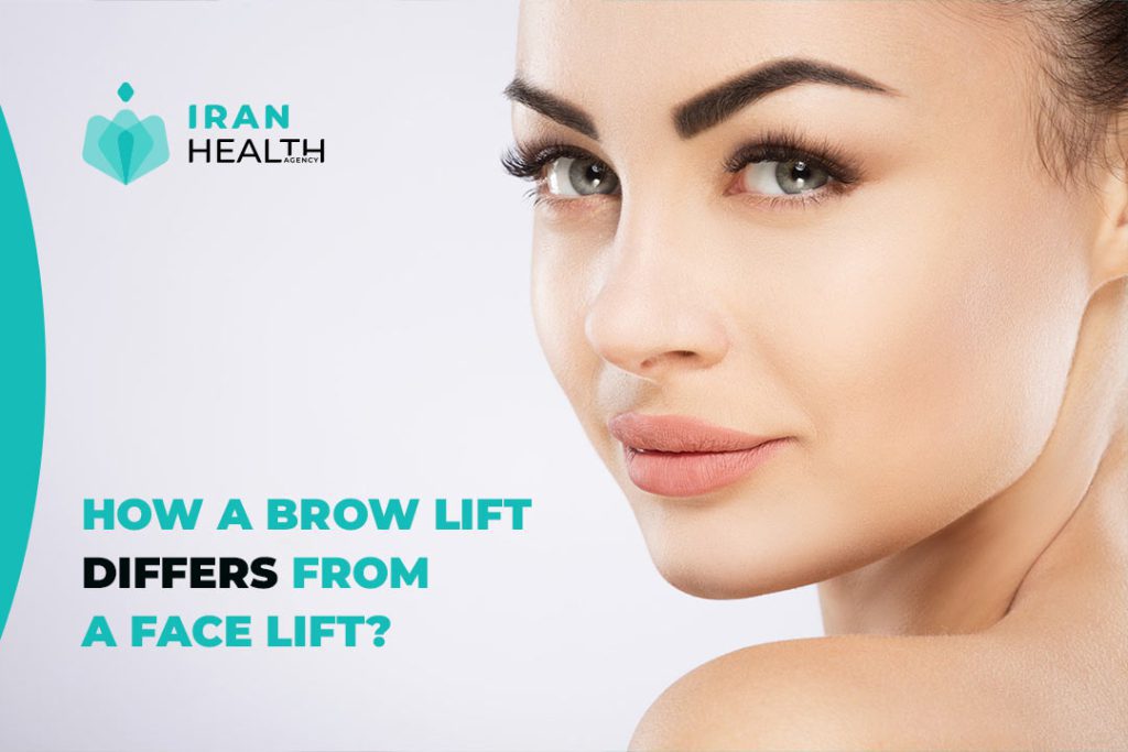 How a Brow Lift Differs from a Facelift