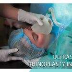 Ultrasonic Rhinoplasty in Iran: Precision Redefined for Aesthetic Enhancement