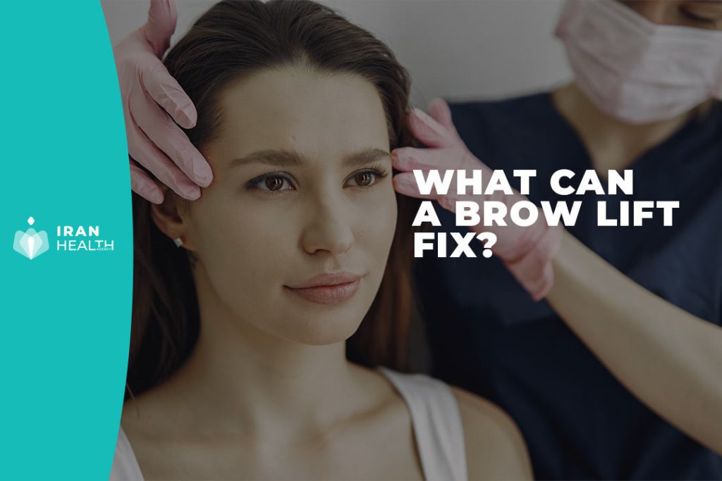 What Can a Brow Lift Fix