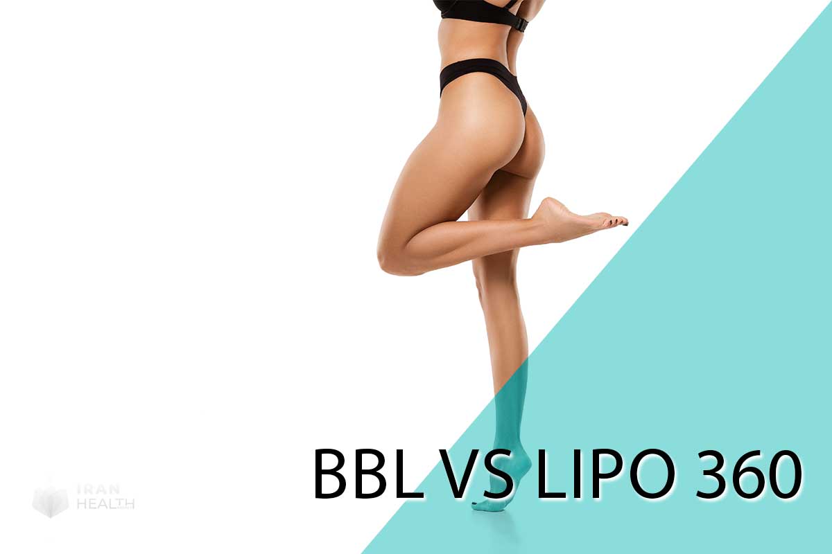 BBL vs Lipo 360