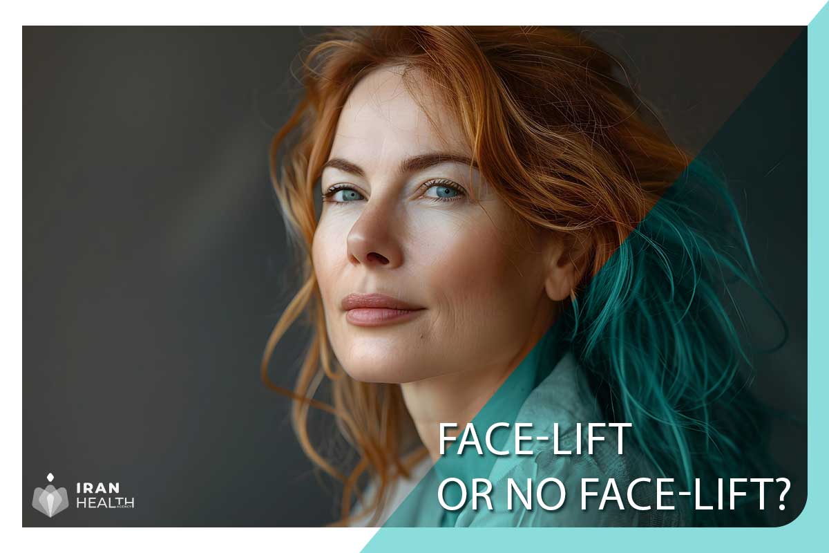 Face-Lift or No Face-Lift?