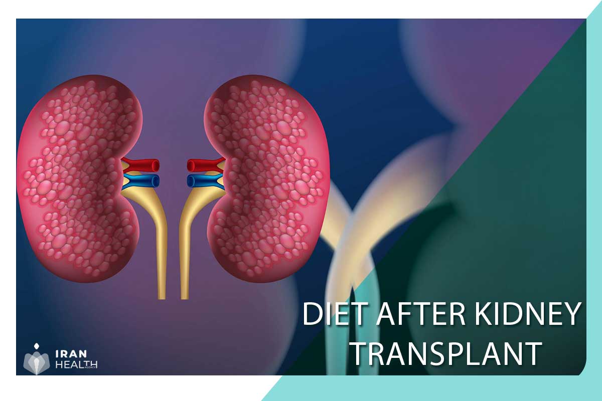 Diet after kidney transplant